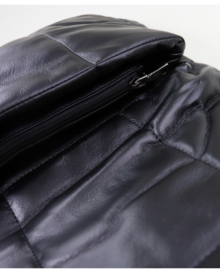 El hombro negro de Lady Bolsa